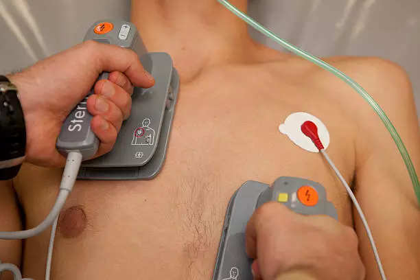 Defibrillator shock deals