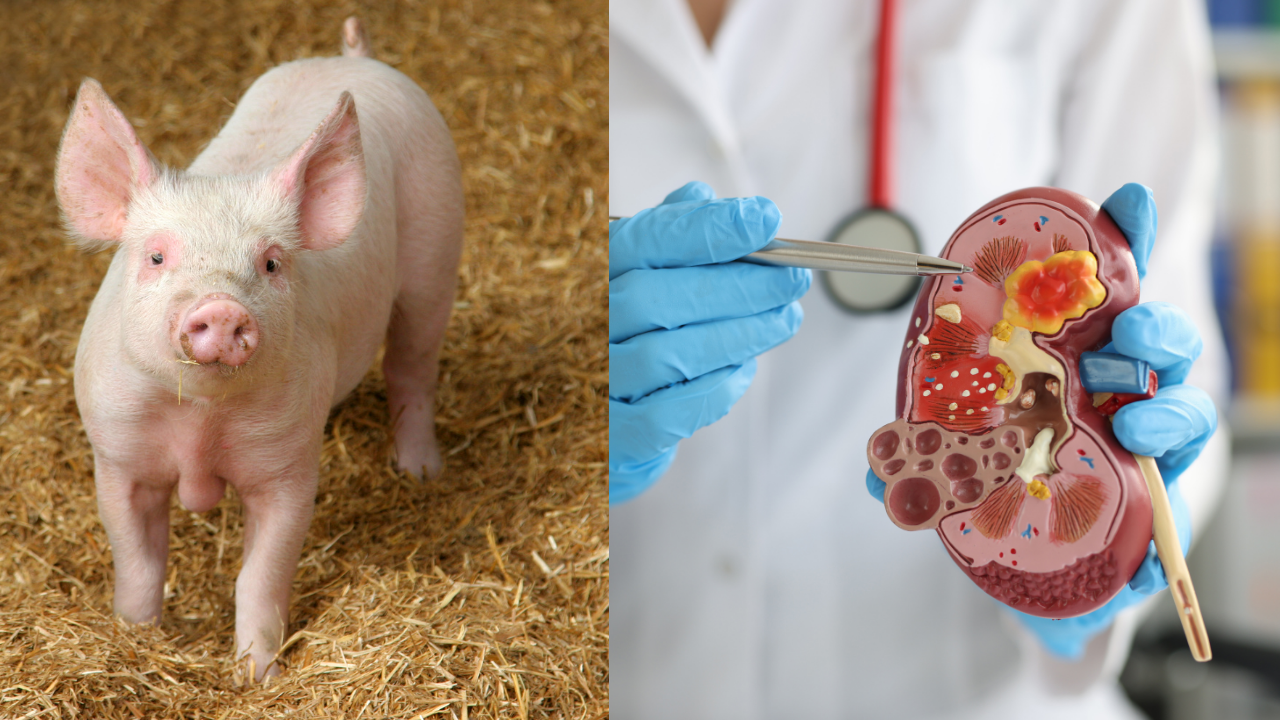 Científicos chinos cultivan con éxito un riñón humanizado dentro de un cerdo, ET HealthWorld