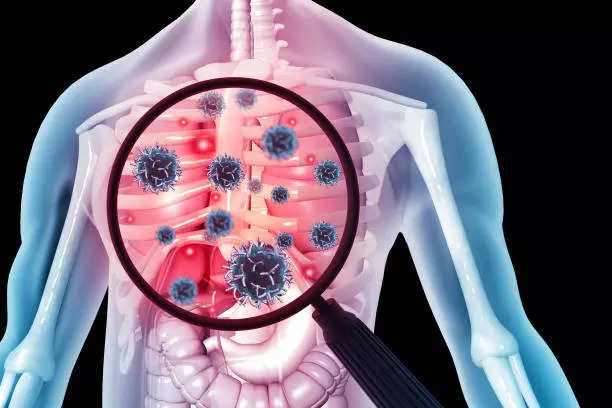 Tuberculosis Detection