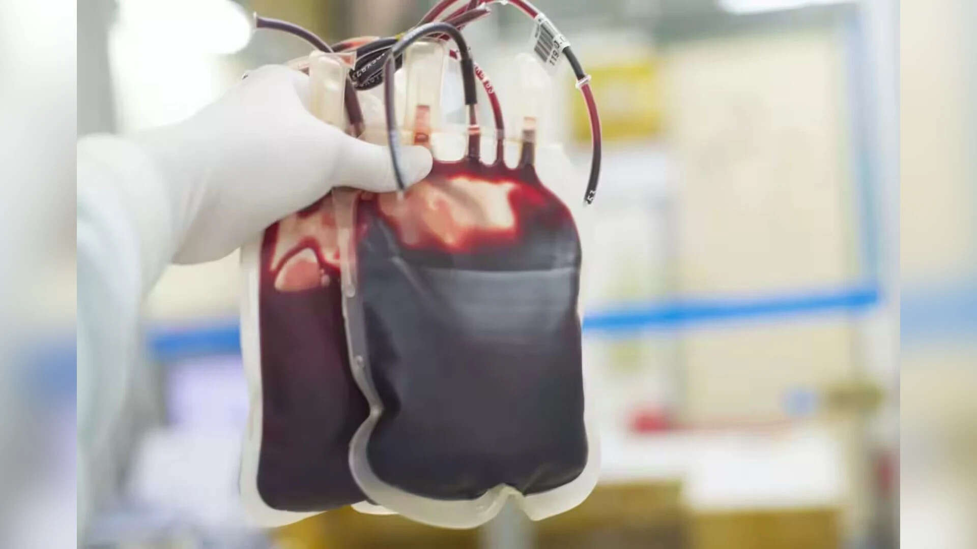 17.4 Lakh Blood Components Discarded in 2025 Despite Record Collection of 15.71 Million Units