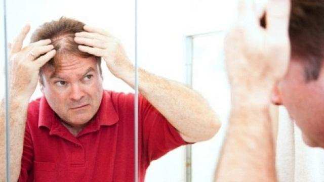 Hair growth drugs may cause erectile dysfunction study Health