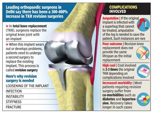 Why ‘new’ knee isn’t the final answer