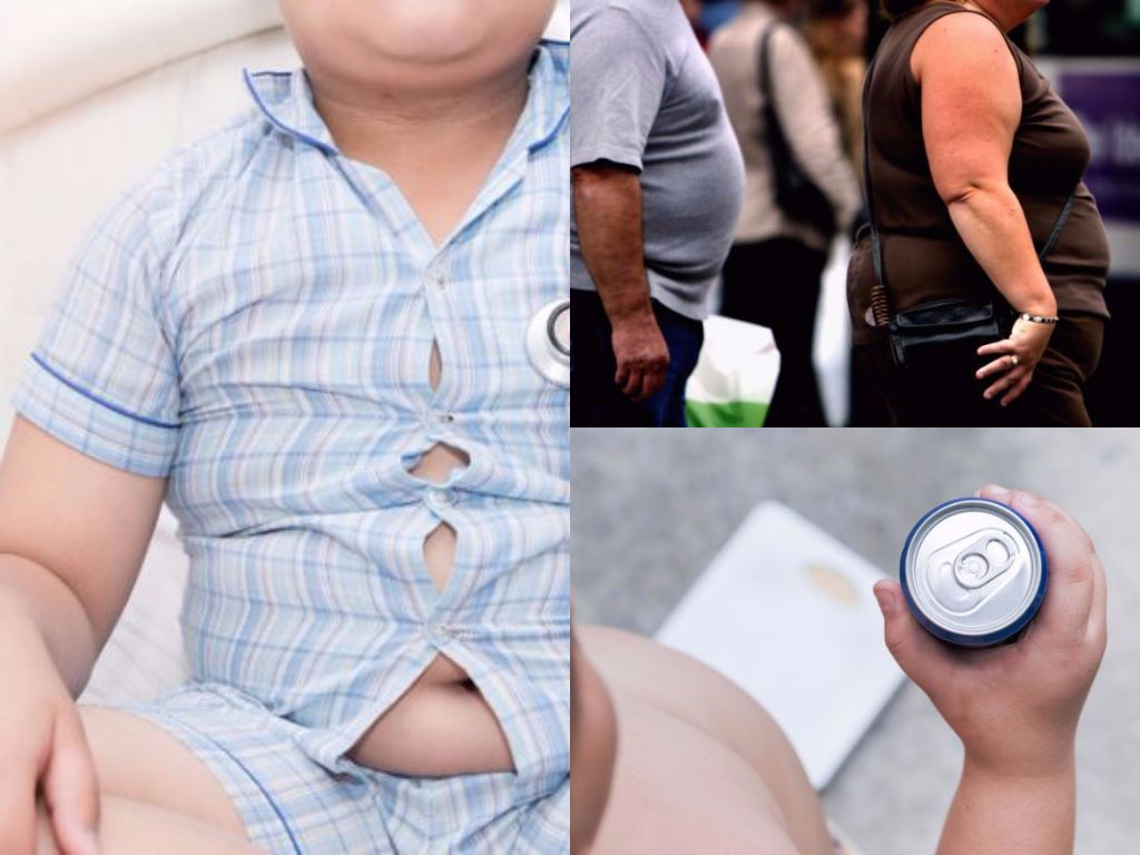 Growing Obesity Epidemic