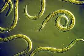 Doctors remove 14 roundworms from woman's bile duct