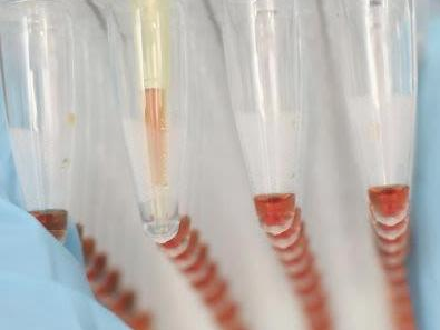 The future of clinical trial conduct demands a quality system approach. Are you ready ?