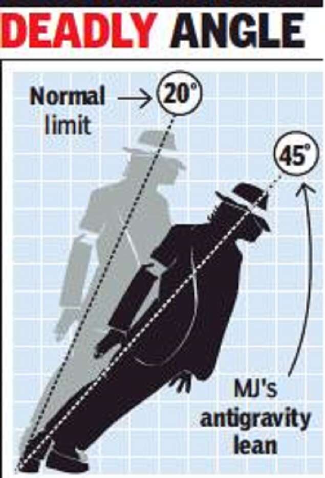 PGI doctors decode how Michael Jackson defied gravity