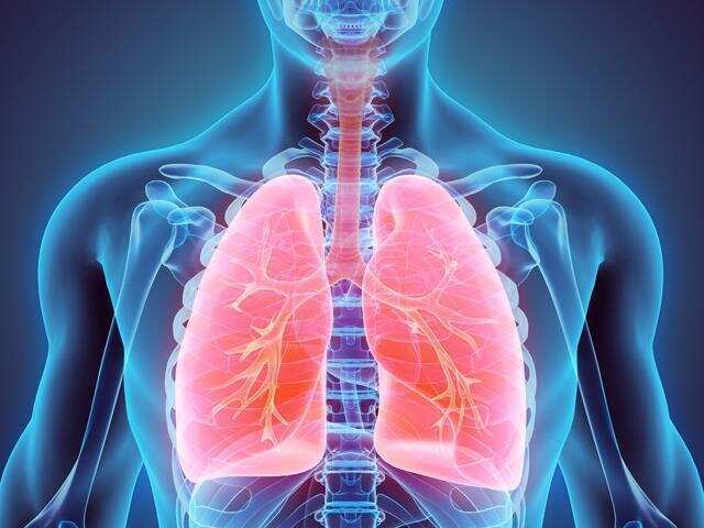 Lung cancer