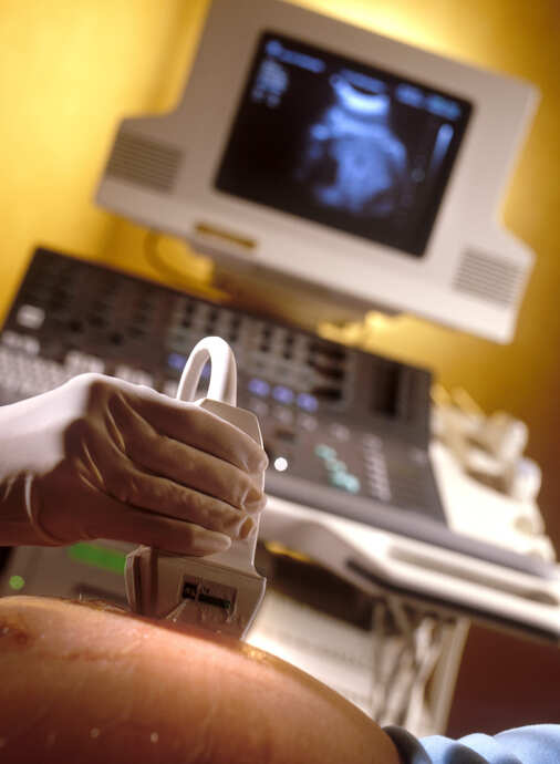Uttarakhand HC asks sonography centres to install observer devices, CMO to track due dates of expectant moms