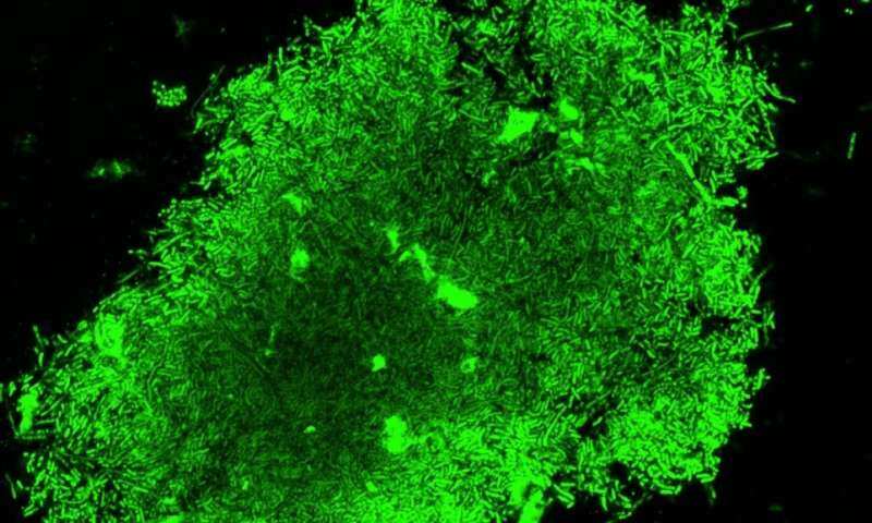 'New imaging technique can spot TB in hour'