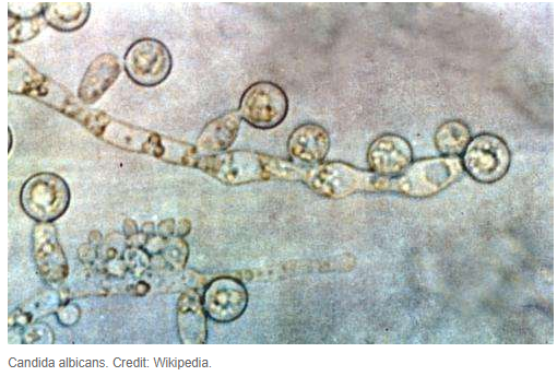 Israeli researchers use soil bacteria to cure fungal infections