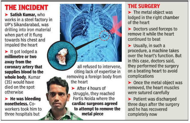 Steel yourself before you read how these doctors removed 4cm metallic object from man’s heart