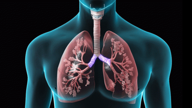 Testosterone replacement therapy may slow progression of COPD