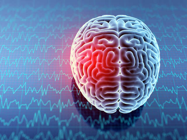 Half of women at risk of dementia, Parkinson's, stroke: study
