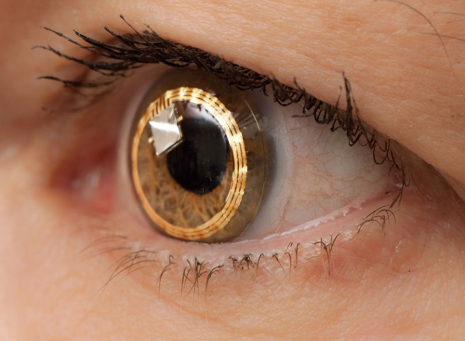 Smart device may help glaucoma patients save eyesight