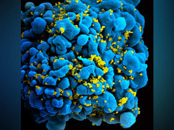 Cellular proliferation keeps HIV infected cells alive: Study