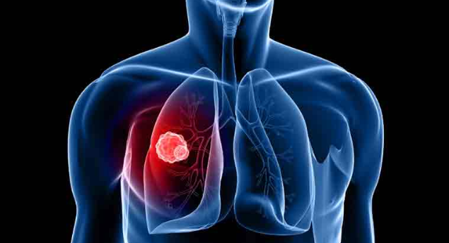 Wasp venom offers hope against lung diseases