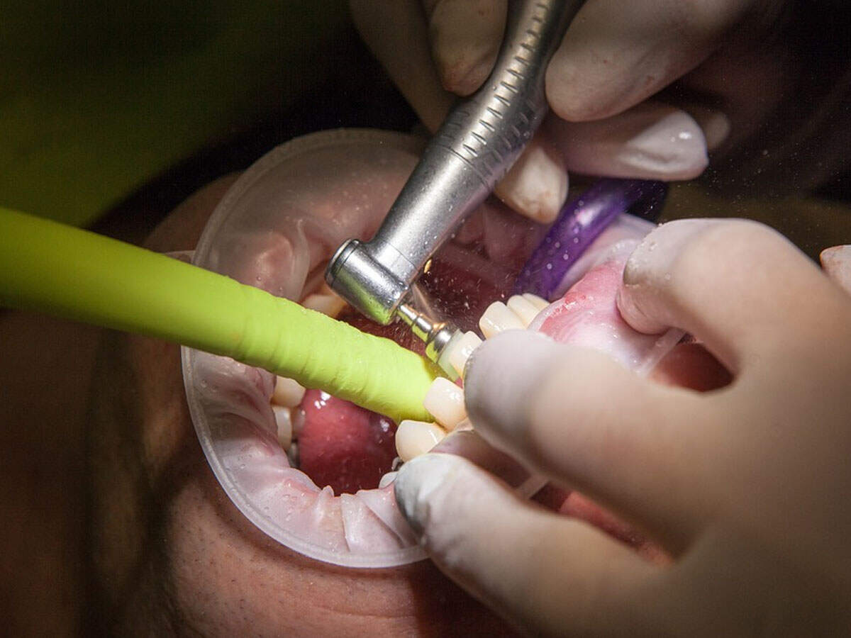Experts: One dentist for 50,000 rural people
