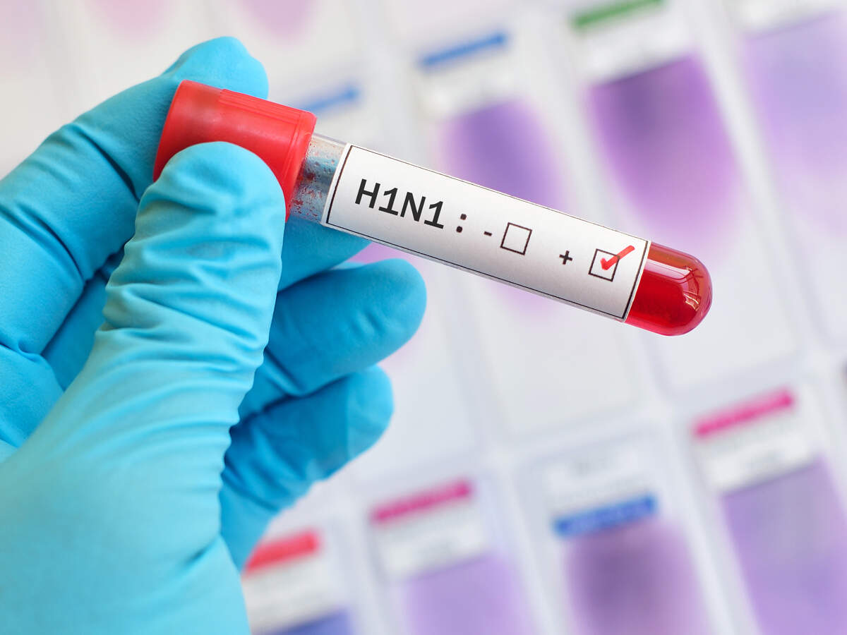 Health department sounds swine flu alert in Uttarakhand