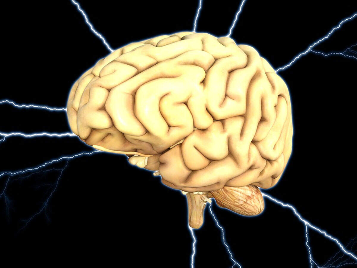 Why women with epilepsy shouldn't hide condition