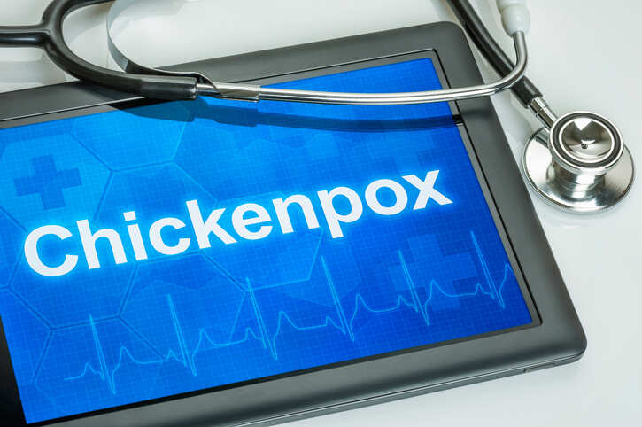 Nagpur: Chickenpox cases go unreported in city