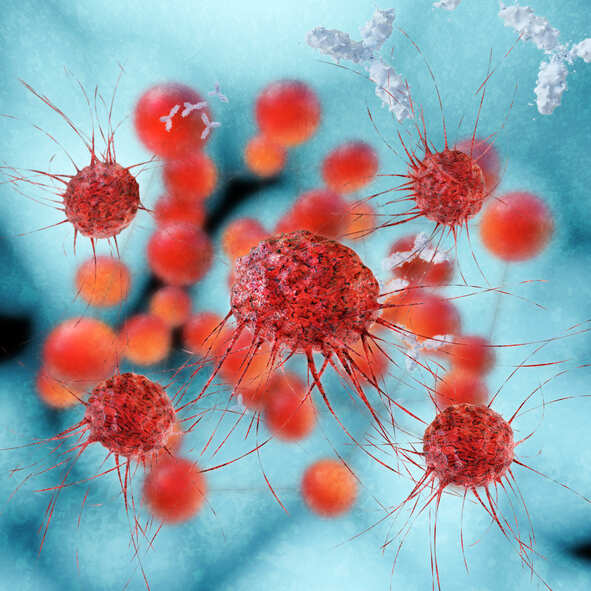 New compound could help treat ovarian cancer