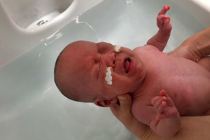 Medical marvel: Baby boy, weighing 268 grams, becomes world's smallest newborn