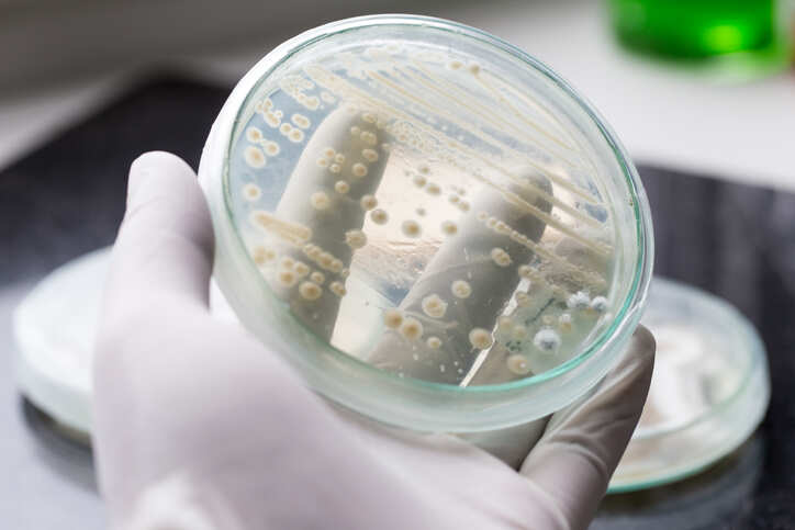 Bacteria found in frog skin may help fight fungal infections in humans