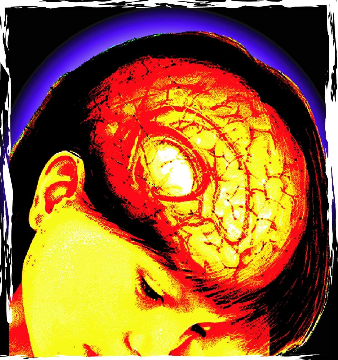Novel strategy to fight most deadly brain tumour in children