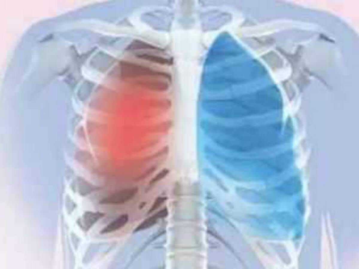 New machine learning model to classify lung cancer types