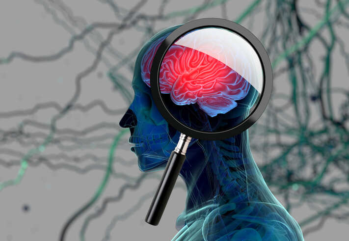 Prolonged hormone therapy linked to Alzheimer's risk: Study