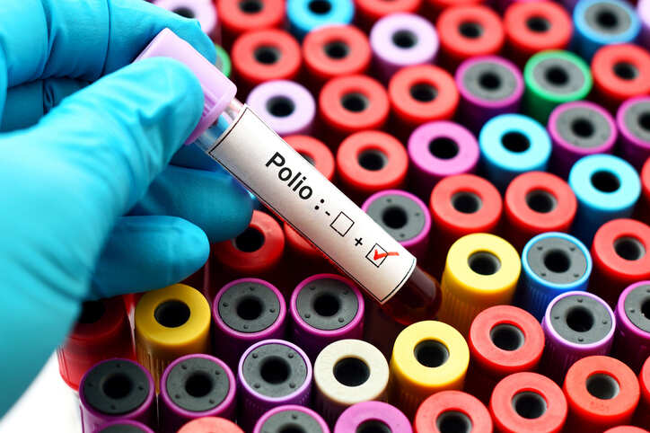 13.3 lakh kids undergo pulse polio vaccination in Bengaluru