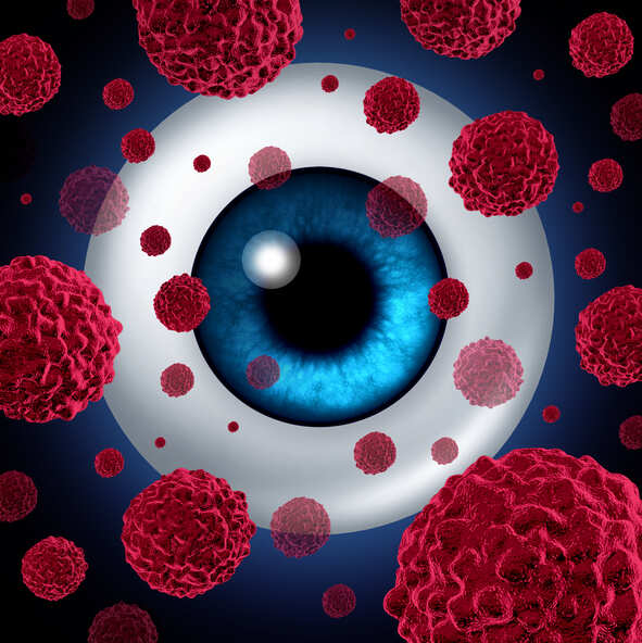 Automated way to detect eye surface cancer developed
