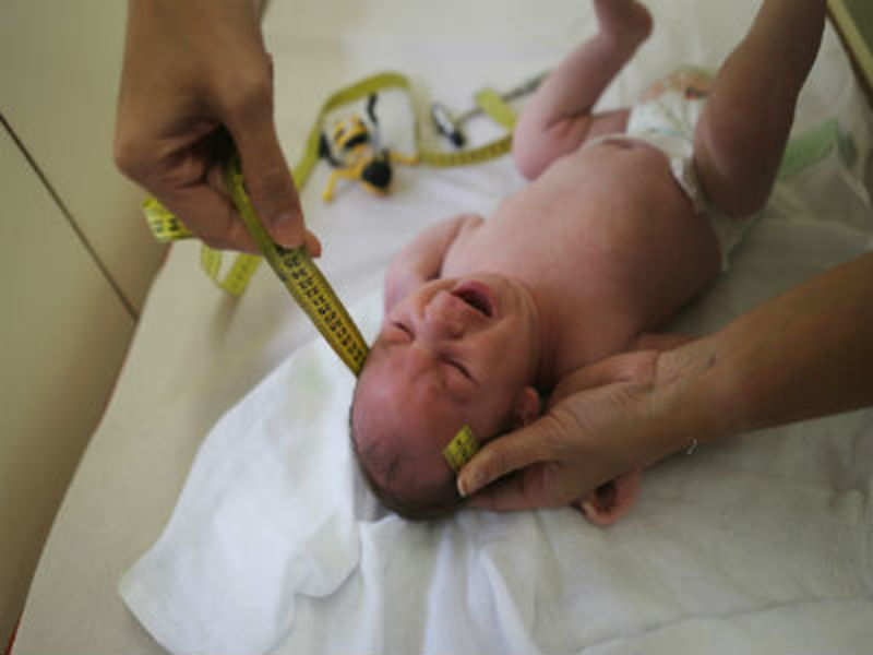 Pune: Docs save baby born with multiple birth defects