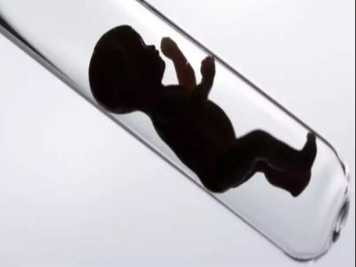 Dutch fertility doctor secretly fathered 49 children