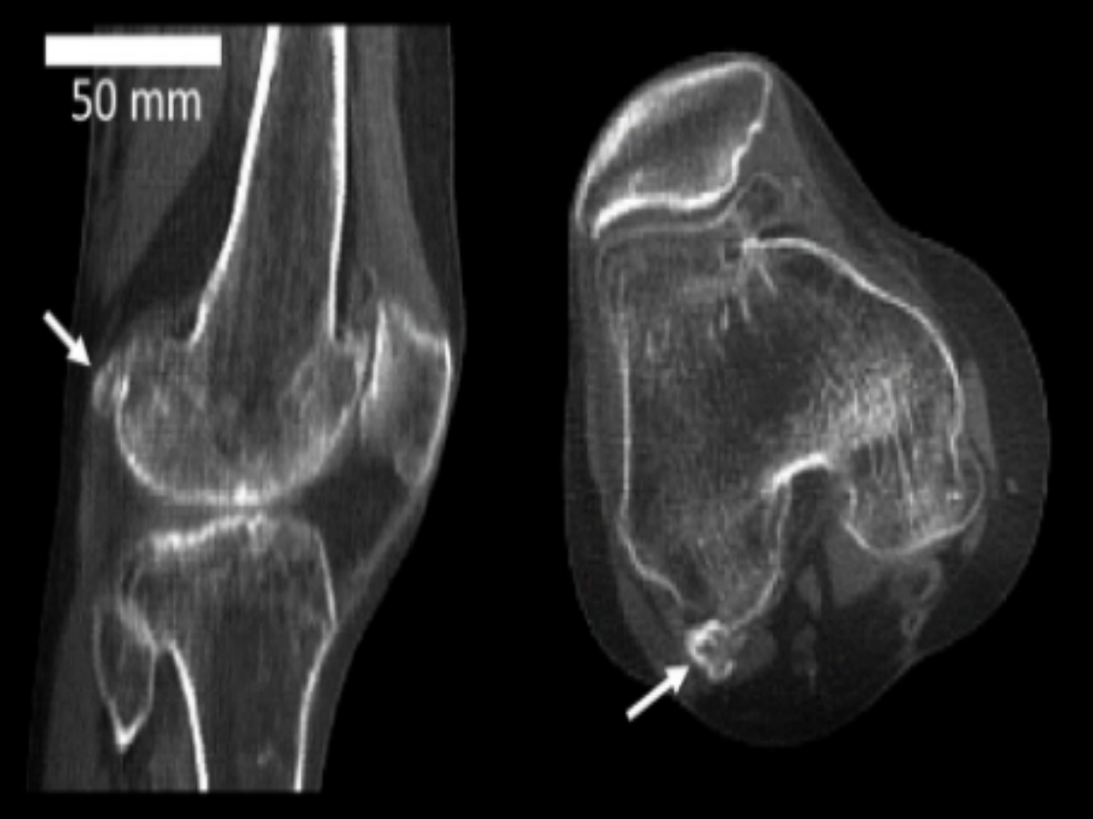 Bone thought to be lost to evolution is making a comeback