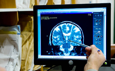 Chinese researchers try brain implants to treat drug addicts