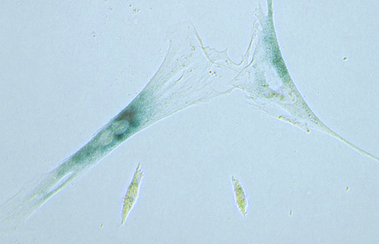 'Zombie cells' buildup in your body may play role in aging