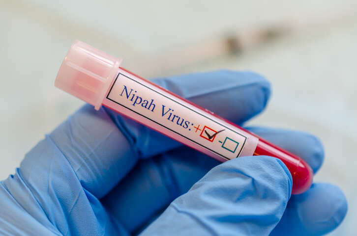 Goa: ‘Health dept working on keeping Nipah at bay’