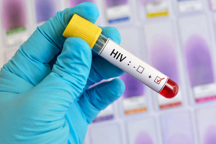 HIV infection ups risk of heart failure, stroke: study