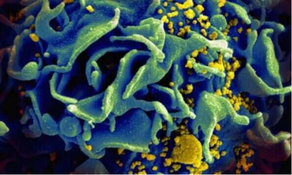 New implant, vaccine trial offer fresh HIV hope