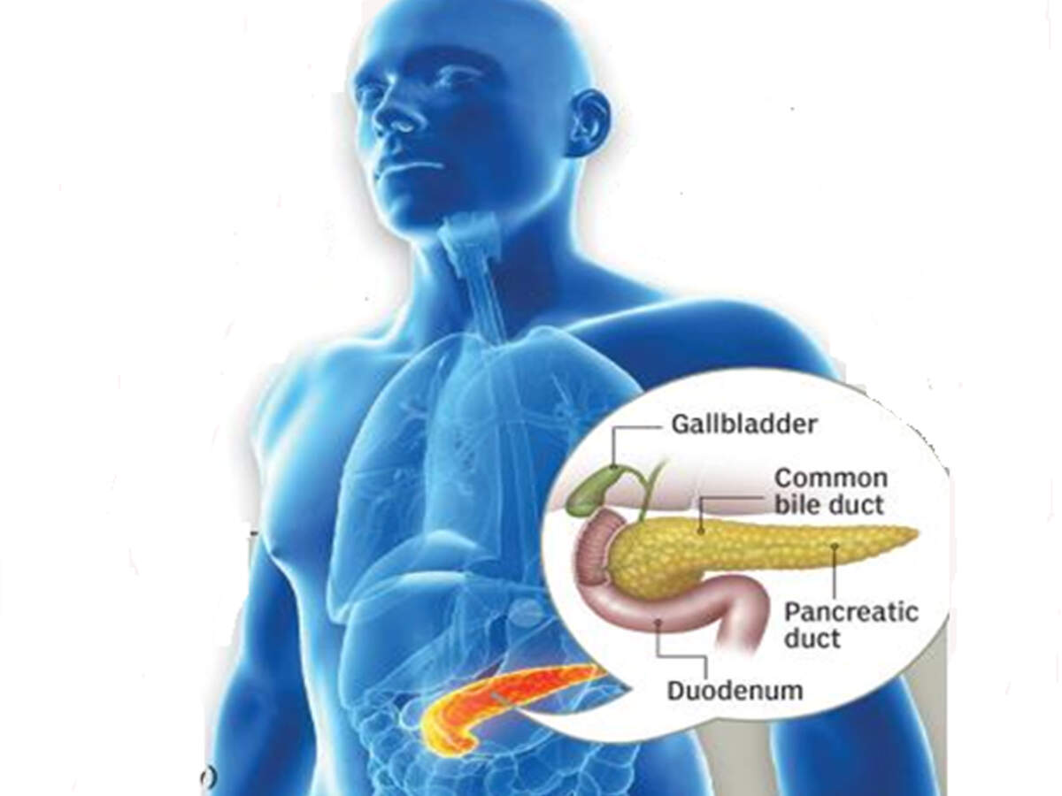 High blood sugar may elevate risk of pancreatic cancer