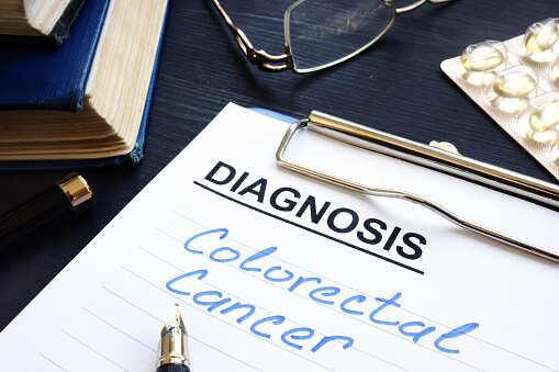 Study claims that bowel cancer screening reduces deaths
