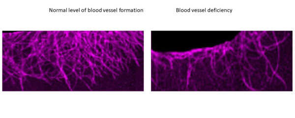 Mechanism for the formation of new blood vessels discovered