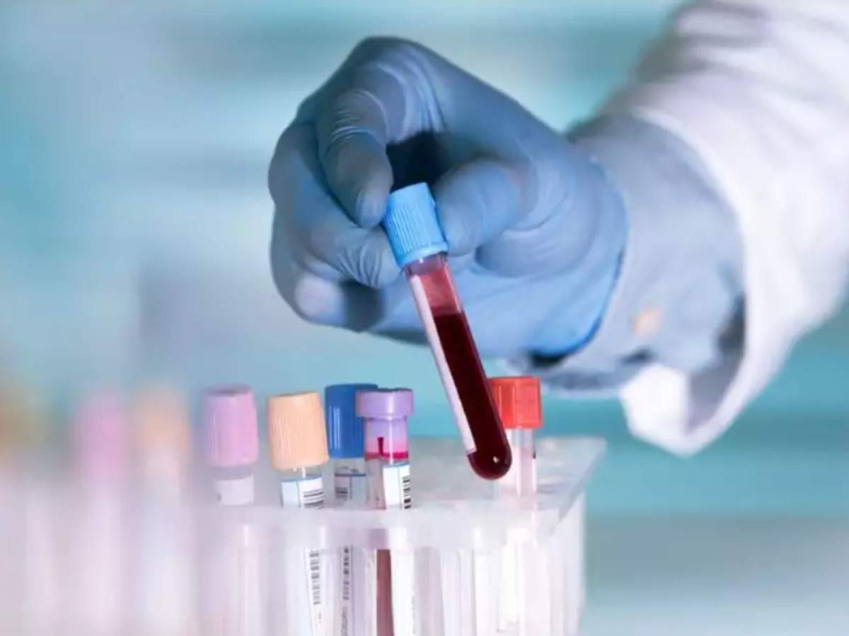 Blood test to spot Alzheimer’s goes on sale
