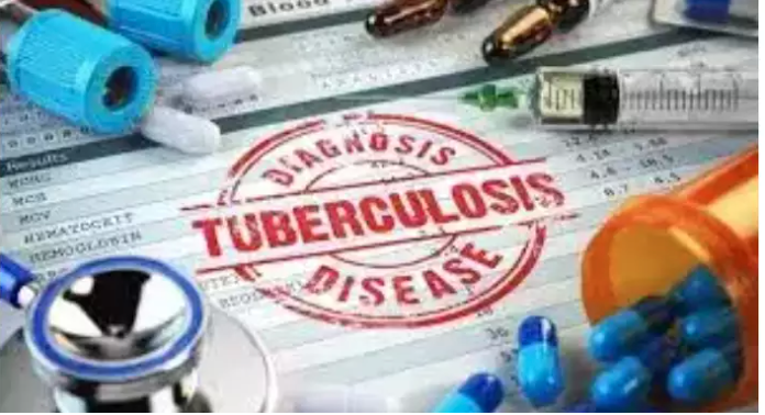 Building support systems to tackle tuberculosis for the most vulnerable