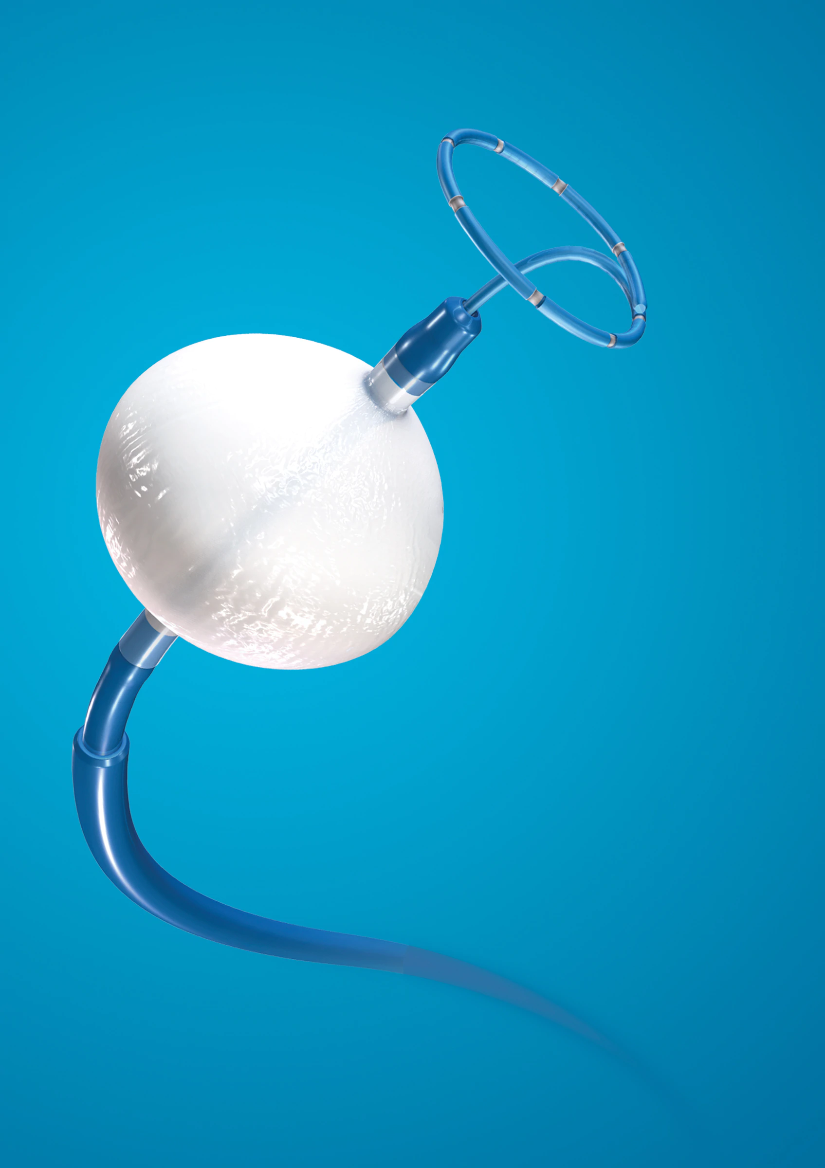 Medtronic India launches Cryoablation Catheter to treat Atrial Fibrillation patients