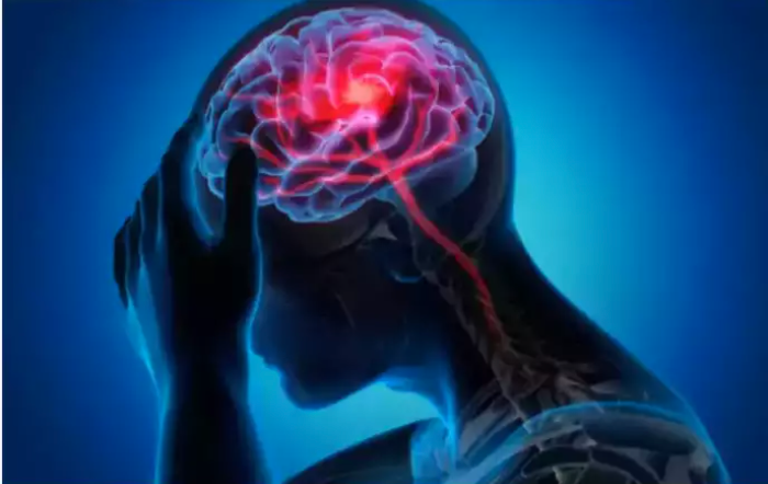 Dealing with Stroke and the Neurological NCD Burden in India