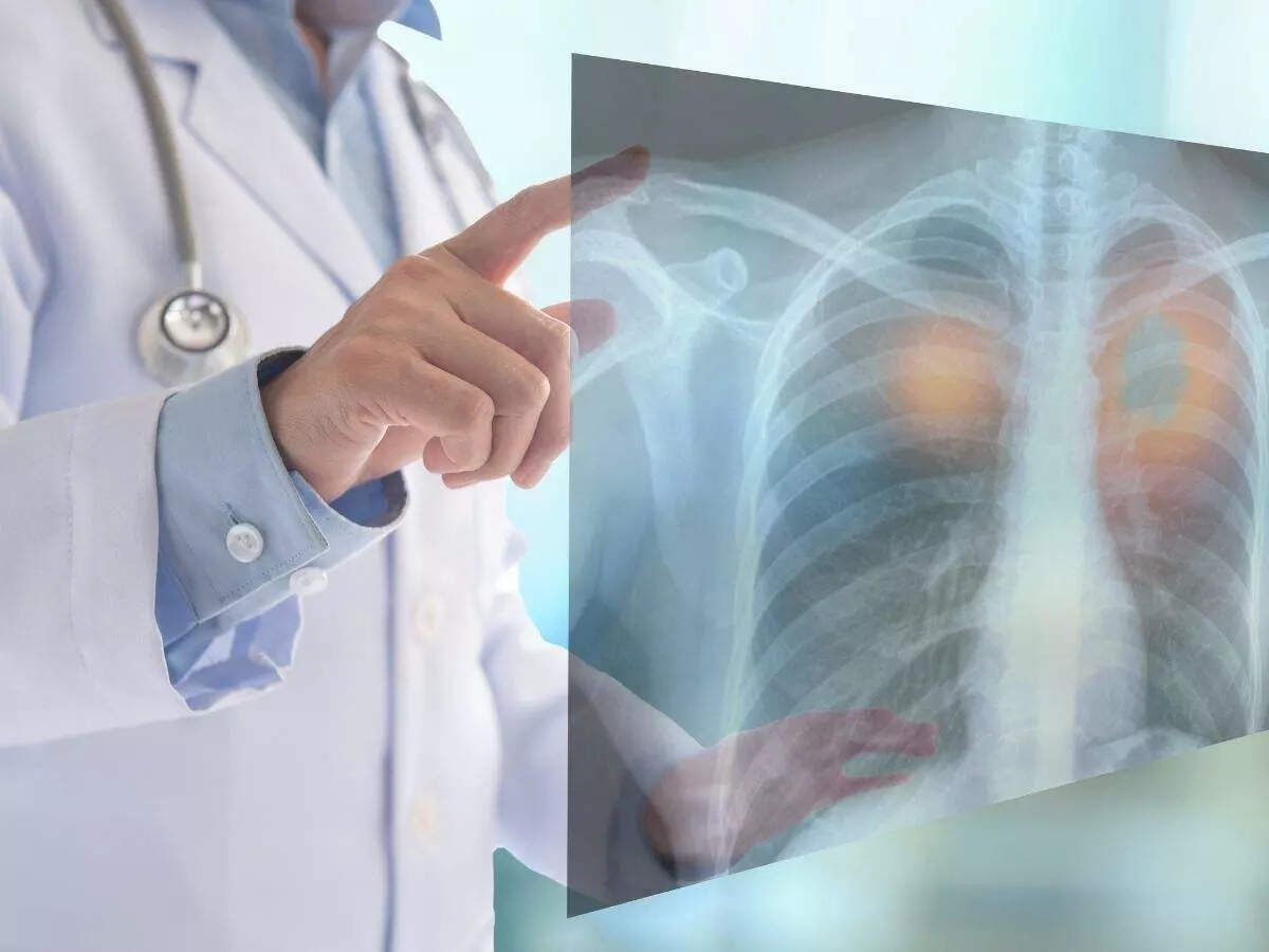 Medanta collaborates with Qure.ai to improve diagnosis of chest ailments