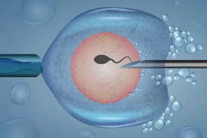 L'augmentation du taux d'infertilité favorise la croissance du marché des technologies de reproduction en Inde