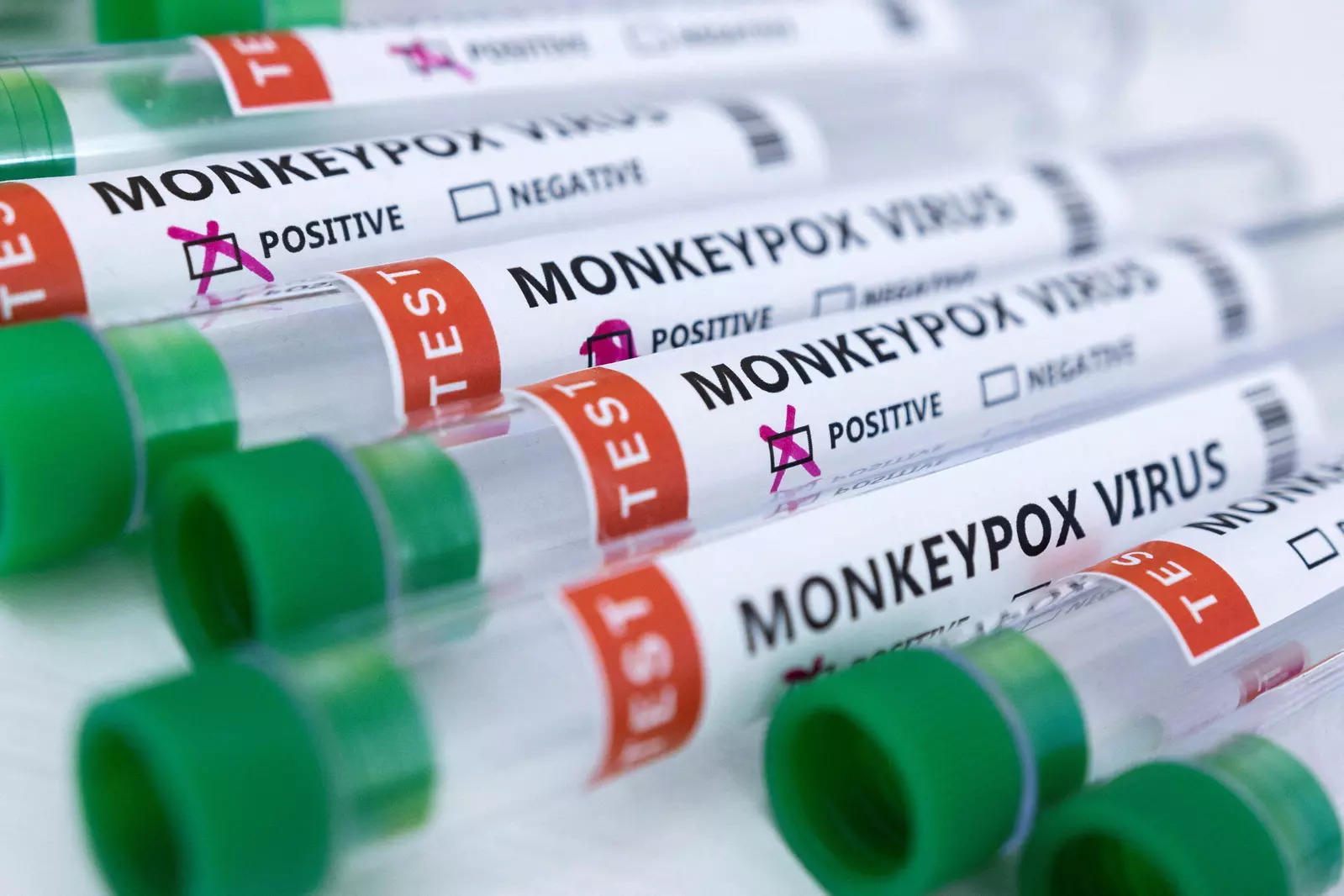 Health Ministry issues ‘Guidelines on Management of Monkeypox Disease’
